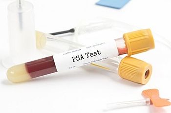 Prostatakrebsscreening mittels PSA-Test